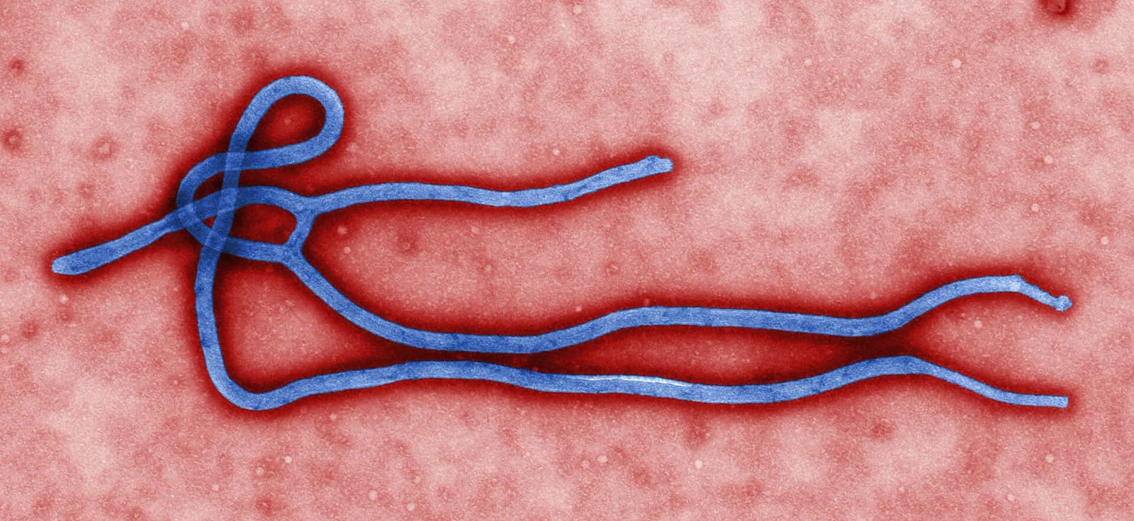 Congo’s Ebola outbreak nears 4,000 deaths with no approved vaccine for strain